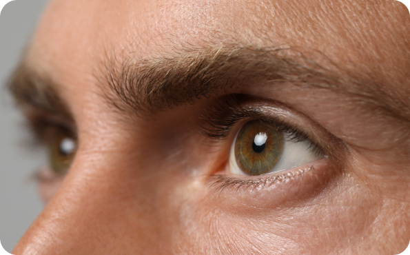 Neuromyelitis Optica (NMO) Image